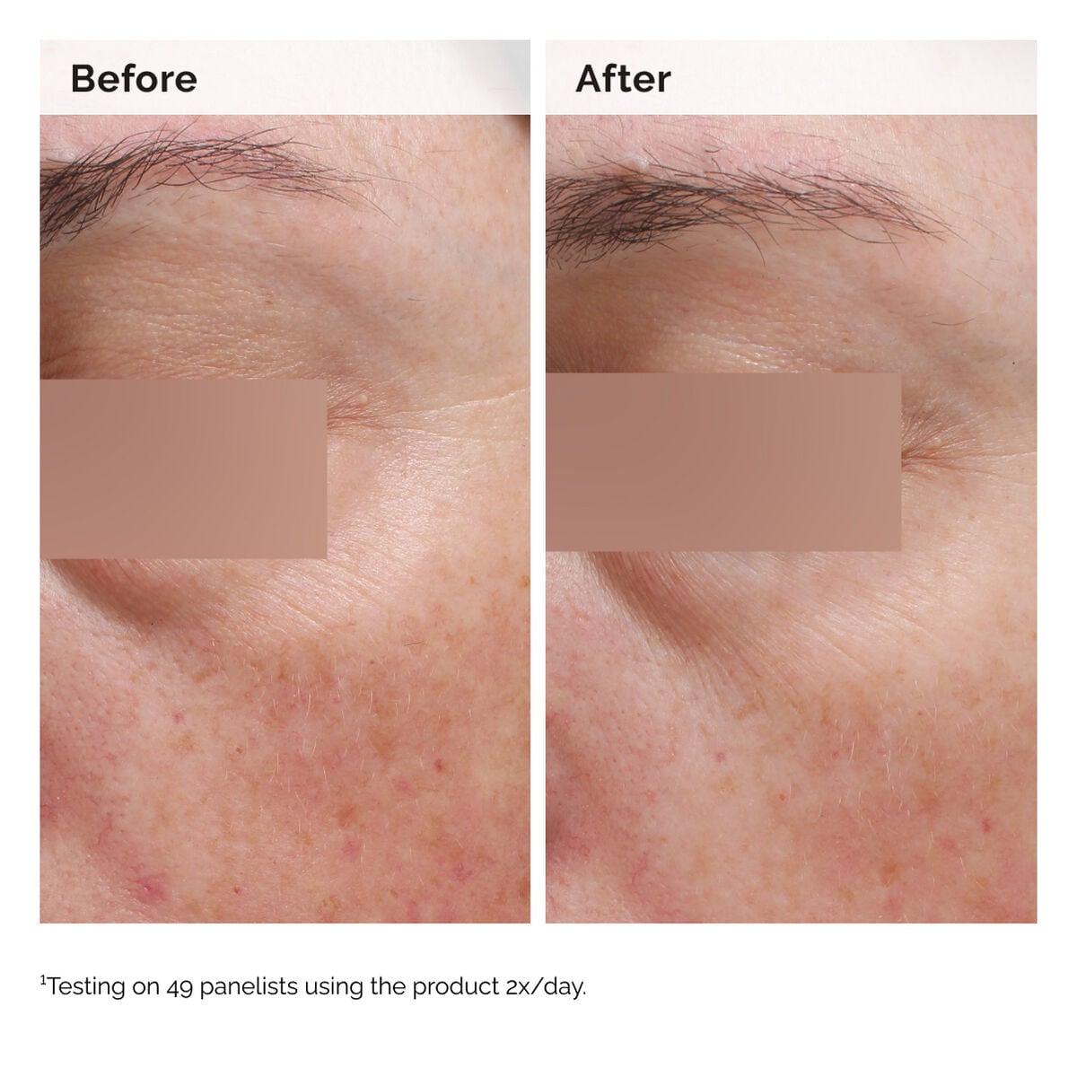 niacinamide-5-face-and-body-emulsion-o1 2024-08-23-ORD-Nia-5pct-Face-Body-B-A-Elasticity-Global-02-1x1.jpg