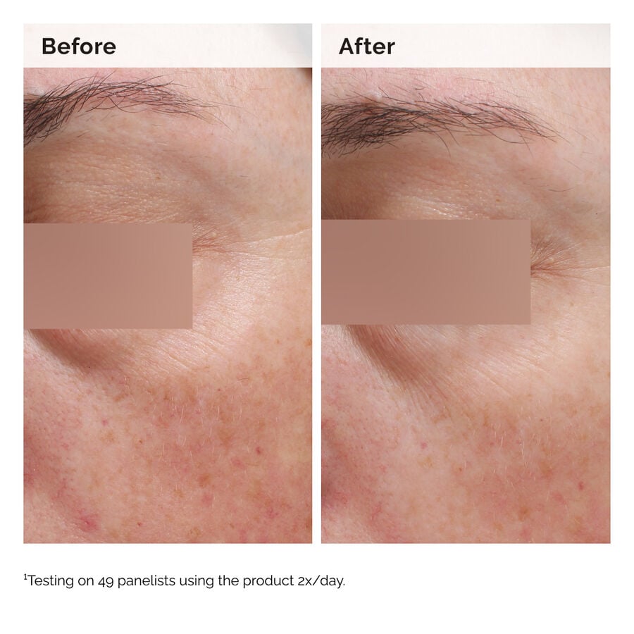 niacinamide-5-face-and-body-emulsion-o1 2024-08-23-ORD-Nia-5pct-Face-Body-B-A-Elasticity-Global-02-1x1.jpg