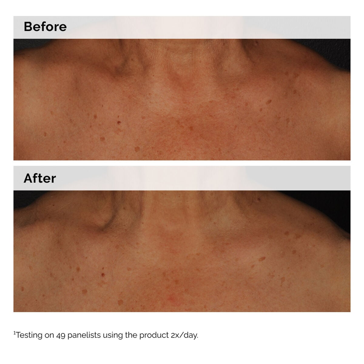 niacinamide-5-face-and-body-emulsion-o1 2024-08-23-ORD-Nia-5pct-Face-Body-B-A-Global-02-1x1.jpg