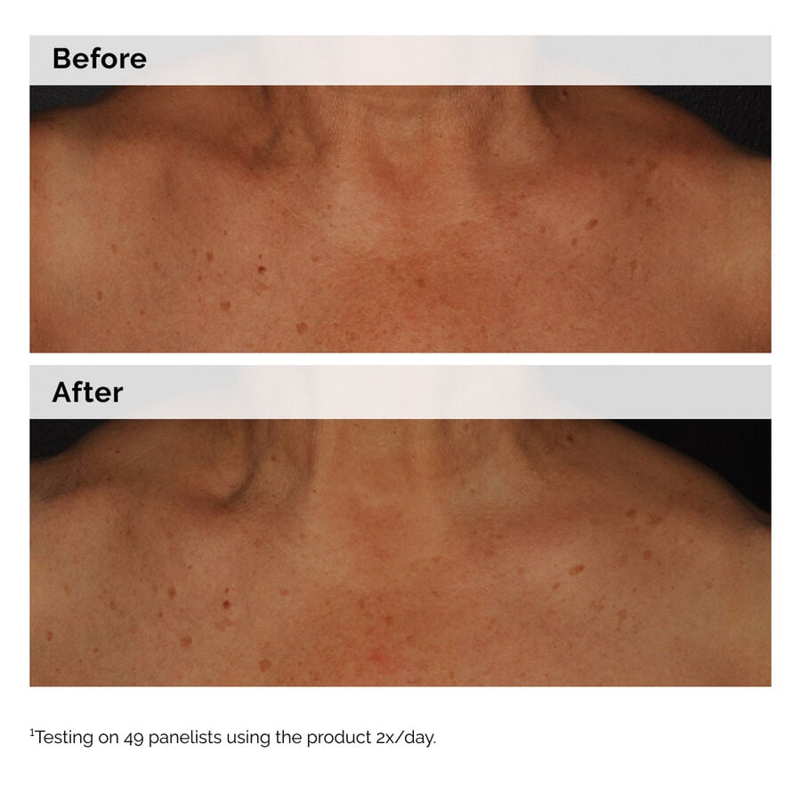 niacinamide-5-face-and-body-emulsion-o1 2024-08-23-ORD-Nia-5pct-Face-Body-B-A-Global-02-1x1.jpg