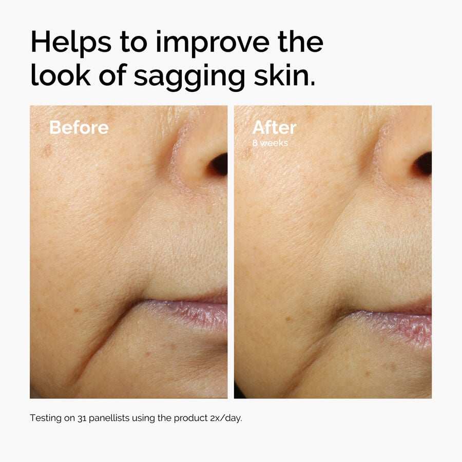 caffeine-3-escin-1-face-serum-v3 ord-caffeine-3pct-escin-1pct-face-serum-before-after-sagging.jpg
