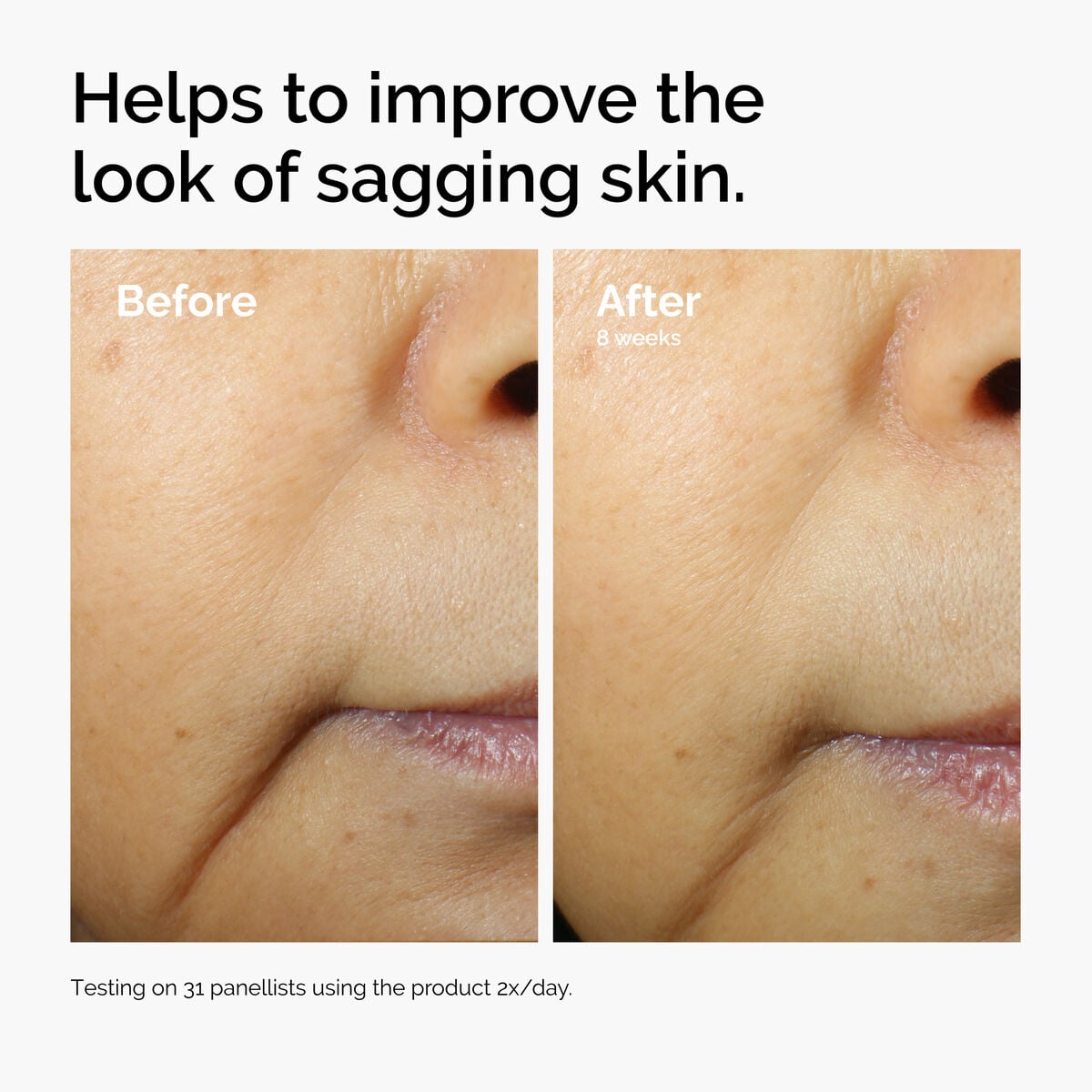 caffeine-3-escin-1-face-serum-v3 ord-caffeine-3pct-escin-1pct-face-serum-before-after-sagging.jpg
