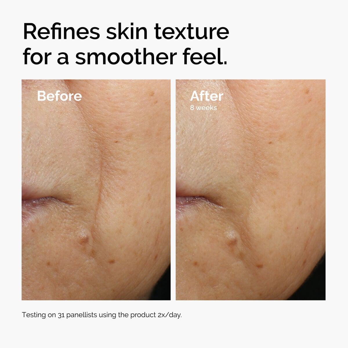 caffeine-3-escin-1-face-serum-v3 ord-caffeine-3pct-escin-1pct-face-serum-before-after-texture.jpg