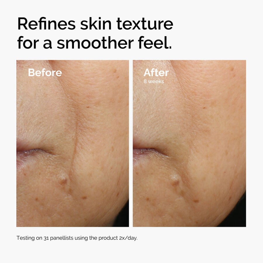 caffeine-3-escin-1-face-serum-v3 ord-caffeine-3pct-escin-1pct-face-serum-before-after-texture.jpg