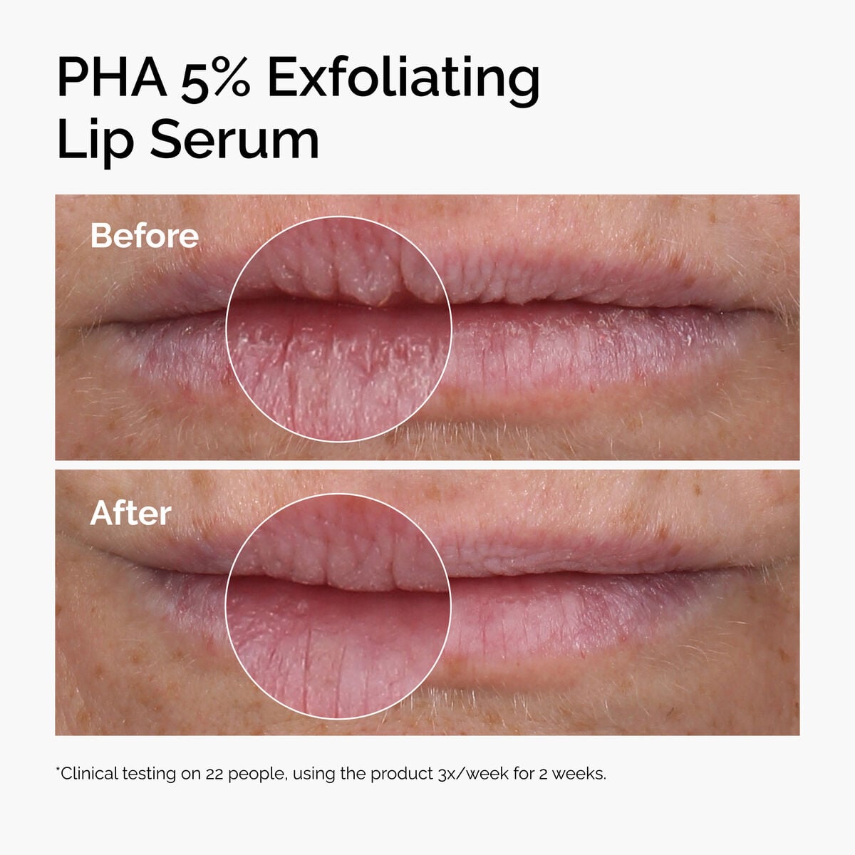 pha-5-exfoliating-lip-serum-h9 ord-pha-5pct-lip-exfoliating-serum-before-after.jpg