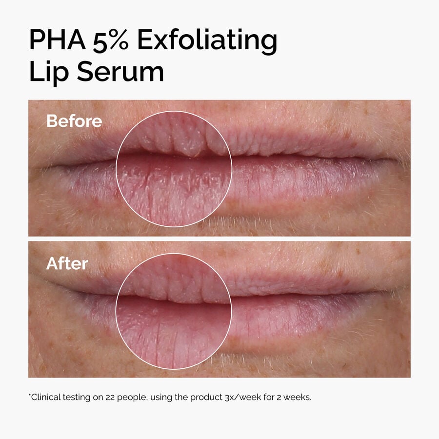 pha-5-exfoliating-lip-serum-h9 ord-pha-5pct-lip-exfoliating-serum-before-after.jpg
